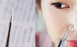 粉刺针正确用法视频